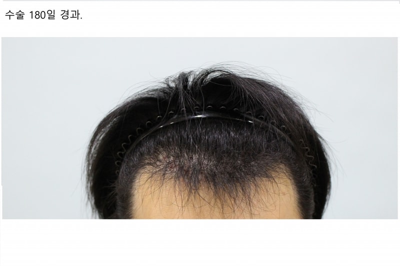 머리1.jpg