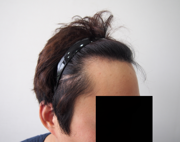 비포2.png