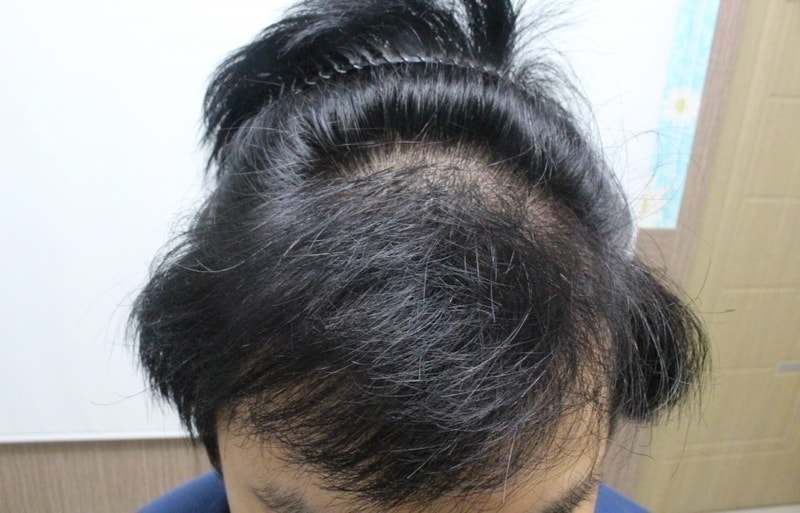 정면2.JPG