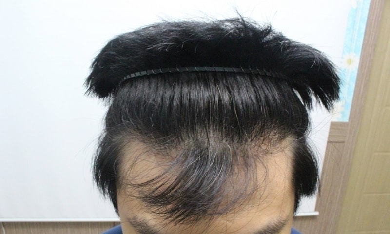 정면1.JPG
