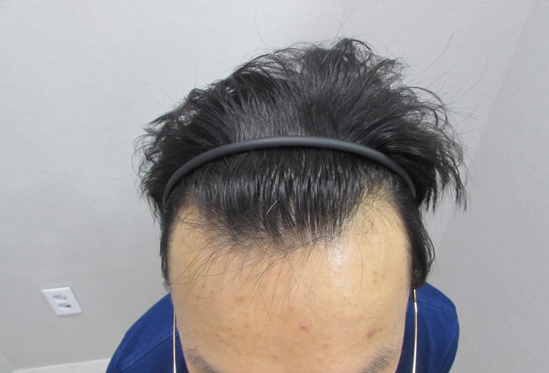 수술전2.jpg