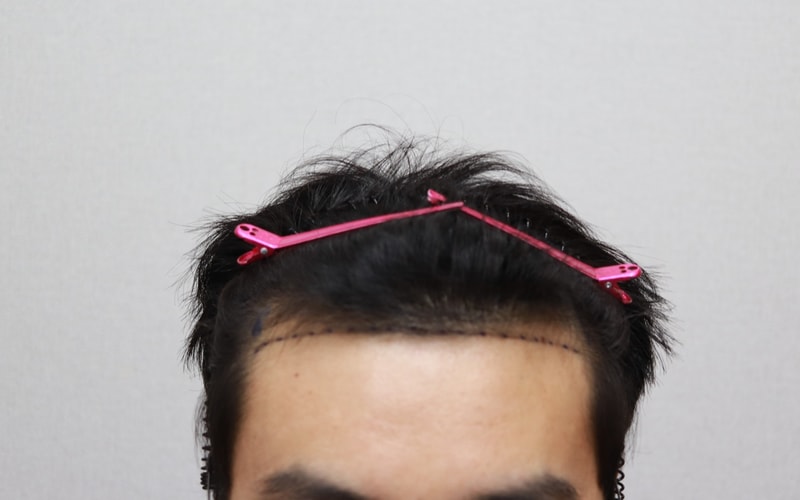디자인후.jpg