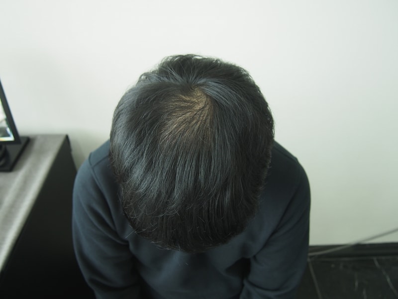 It's before and after the crown reinforcement surgery