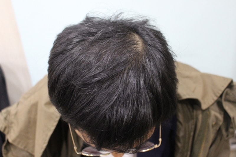 후1.jpg