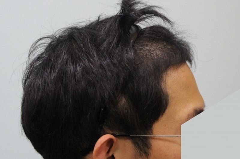 후3.jpg