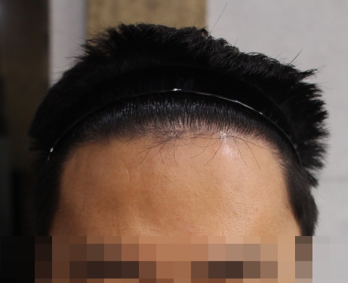 6개월 나름 성공적인 후기 올려봅니다