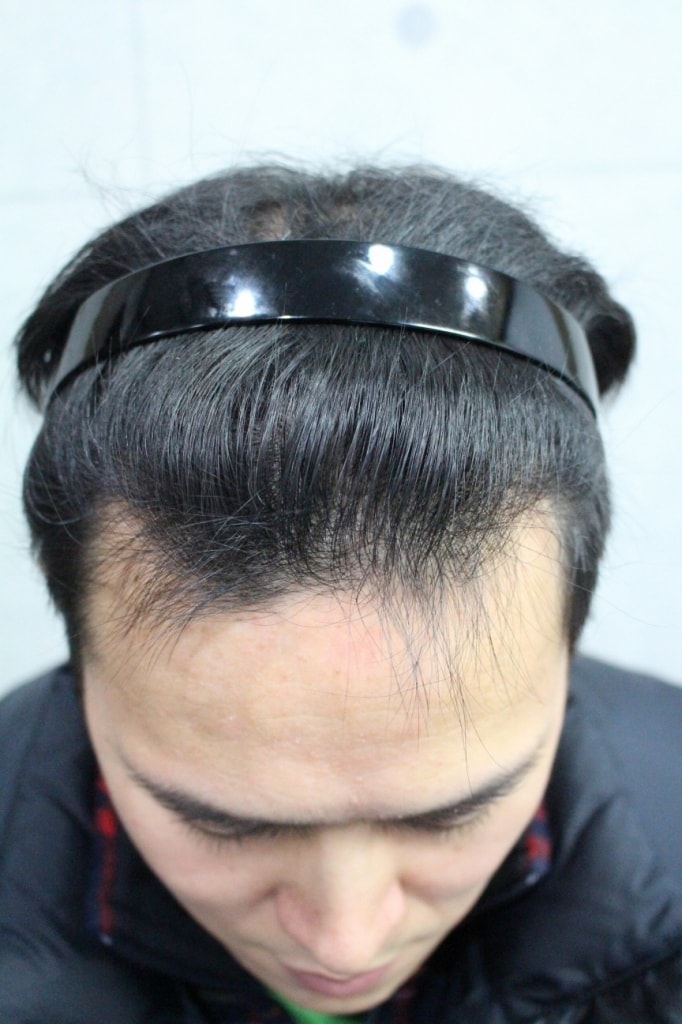회전_IMG_3152.JPG