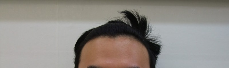 수술전2.jpg