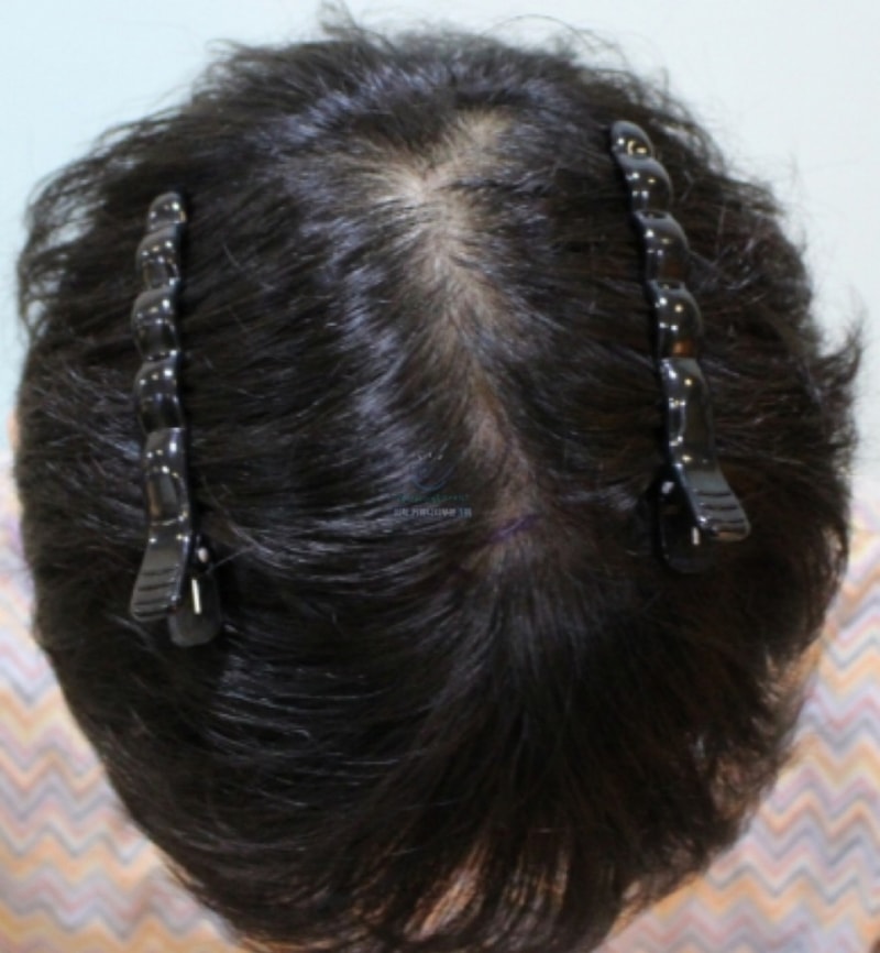 Non-cut 3,000-mo 4th month