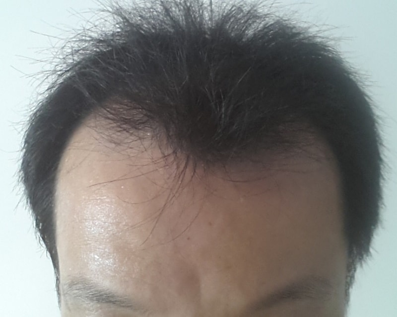 수술전.jpg