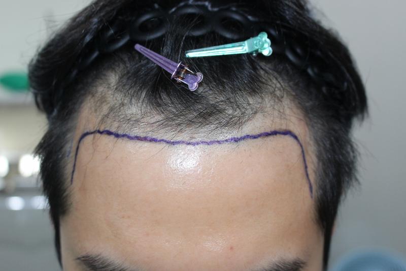 [Rep. Modaol] Director Hong Jun-hyun's review of 4,900 hair cuts