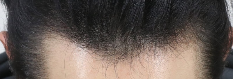 수술전.jpg