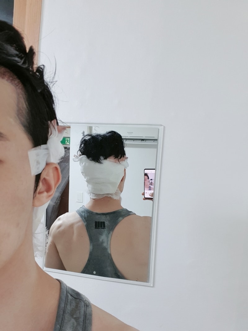 1일뒤.jpg