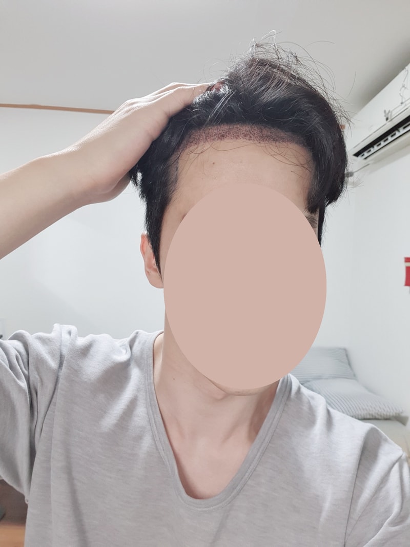 2일앞.jpg