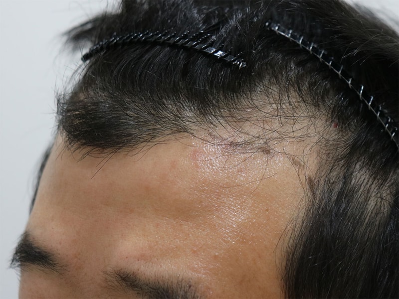 수술 전 3.jpg