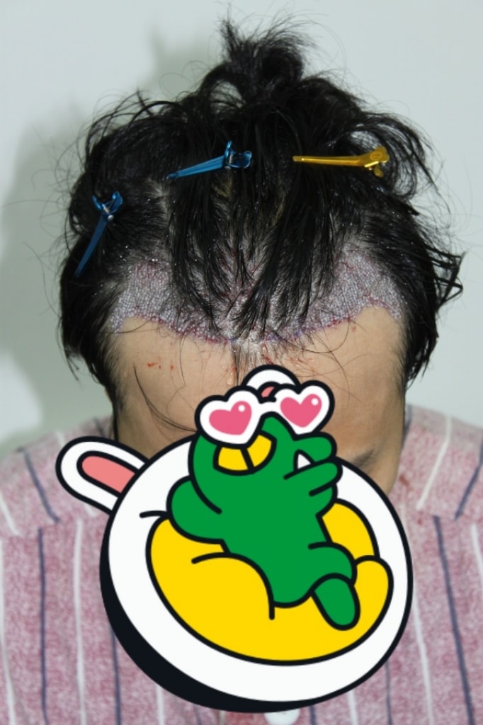 후.jpg