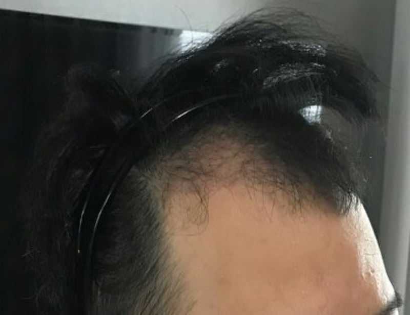 It's been 3 months since I cut my hair