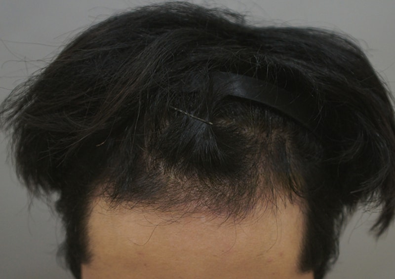 후1.JPG