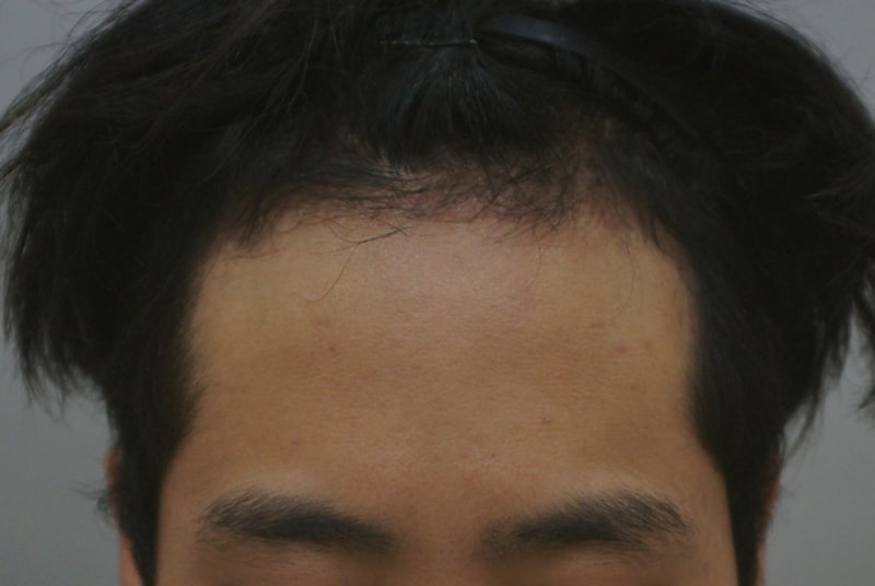 후2.JPG