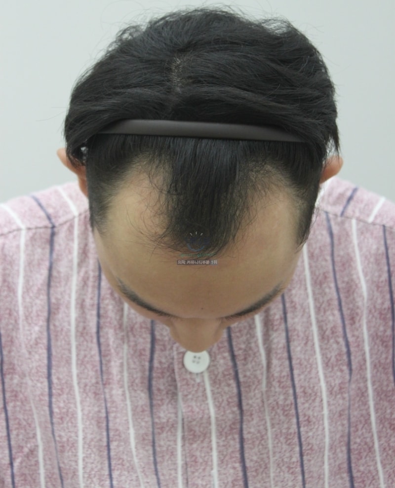 手术经过