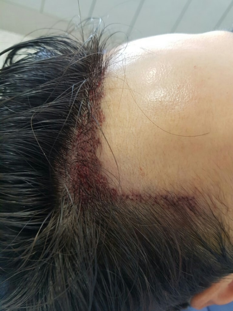 KakaoTalk_20170627_173538341.jpg