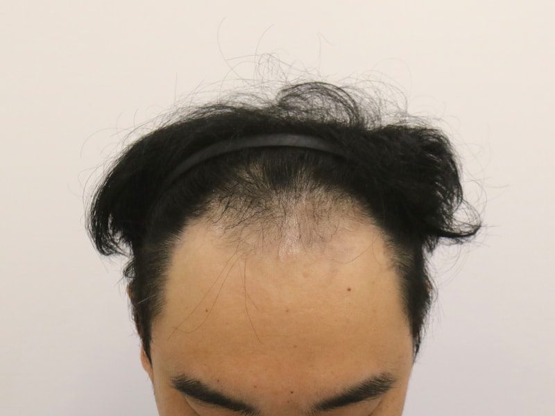 수술전.jpg