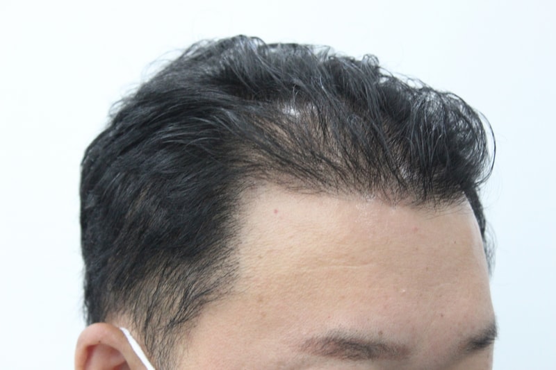 수술전3.jpg