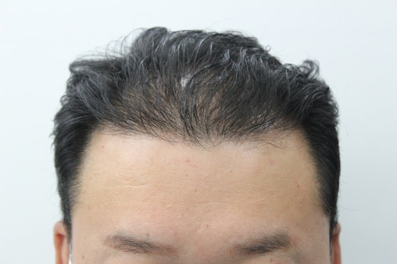 8개월 조금 넘은 결과 올립니다
