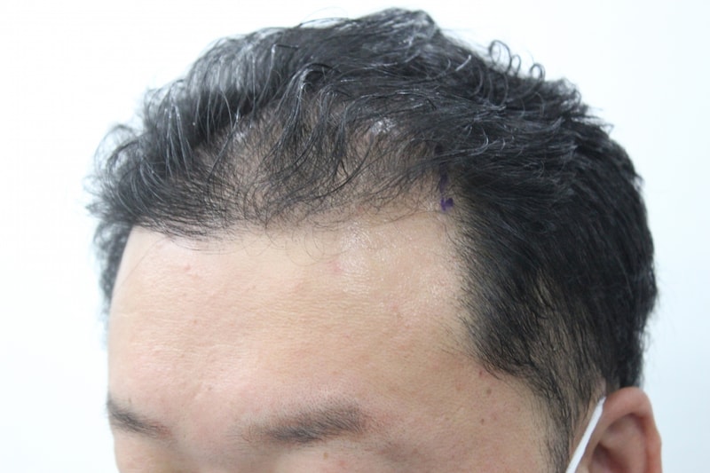 수술전2.jpg