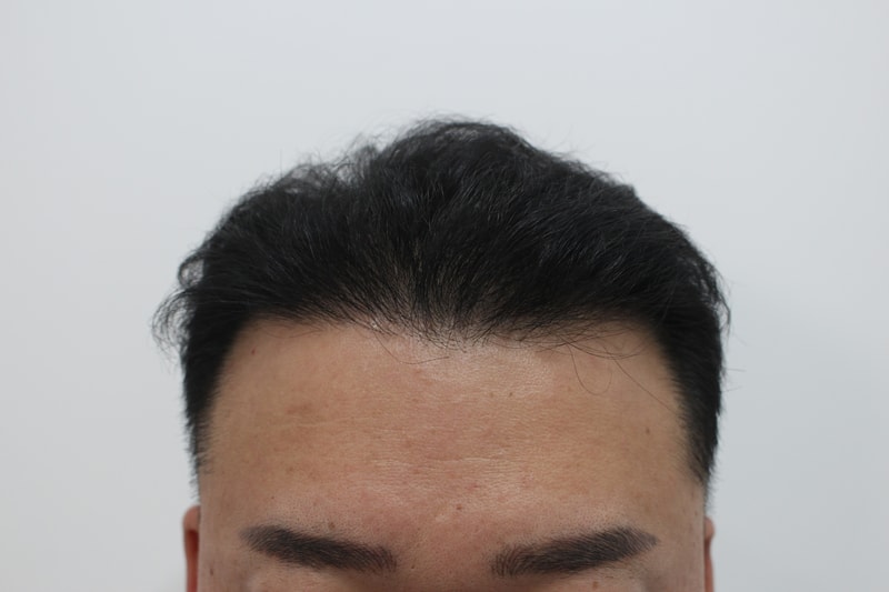 수술후1.jpg