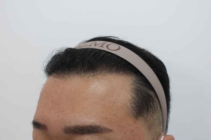 수술후2.jpg