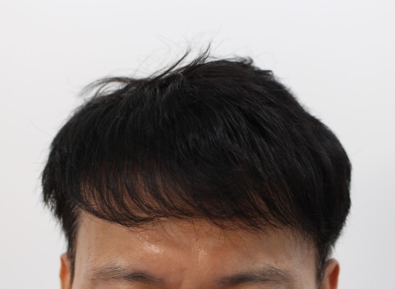후 내리고.jpg