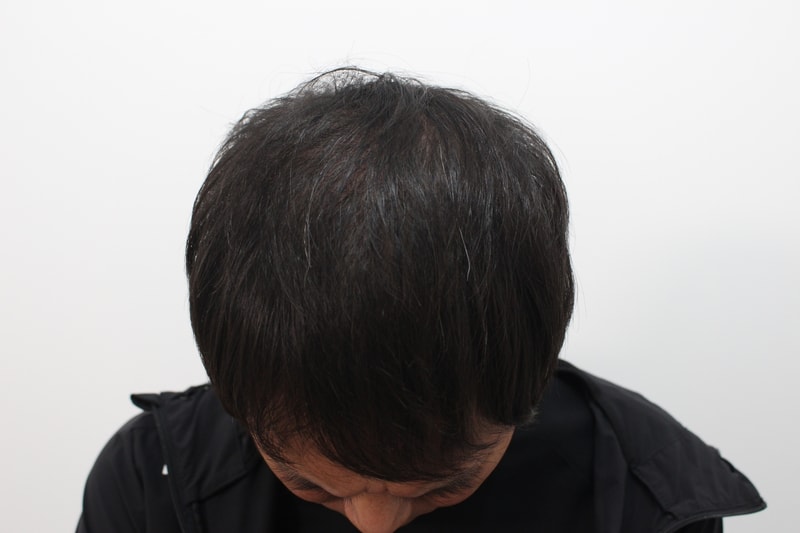 8개월.jpg