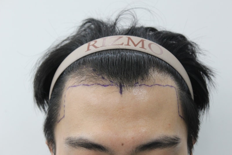 디자인 앞.jpg