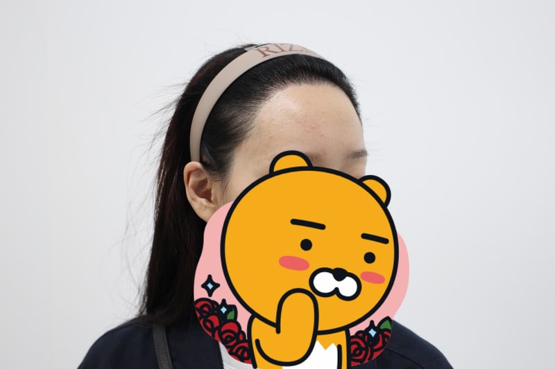수술후 1년차 오른족 멀리서.jpg