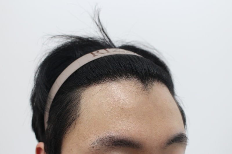 1년차 측면.jpg