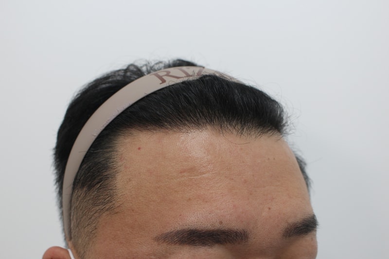 수술후3.jpg