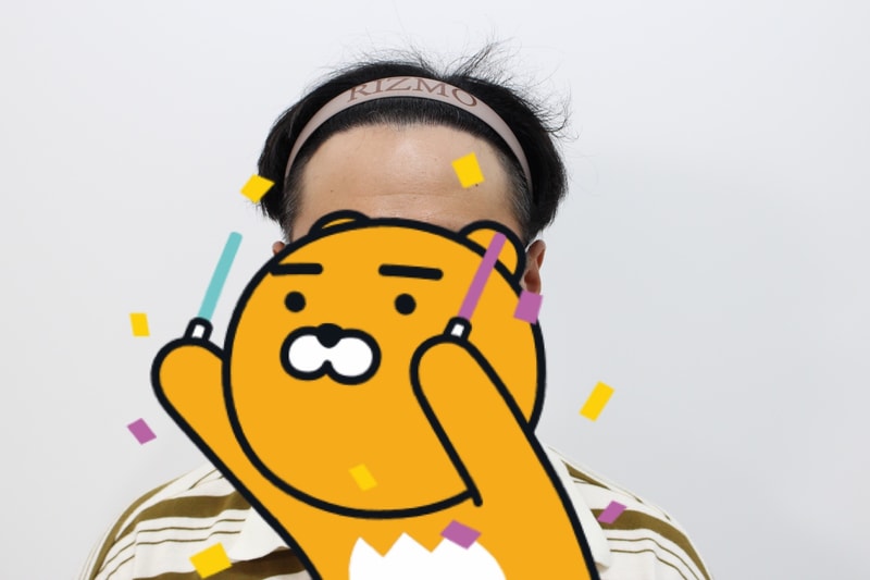 7부산 리즈모 수술후 240일차에는 엠자 사라지고 내가 원하던 라인이 나옴.jpg