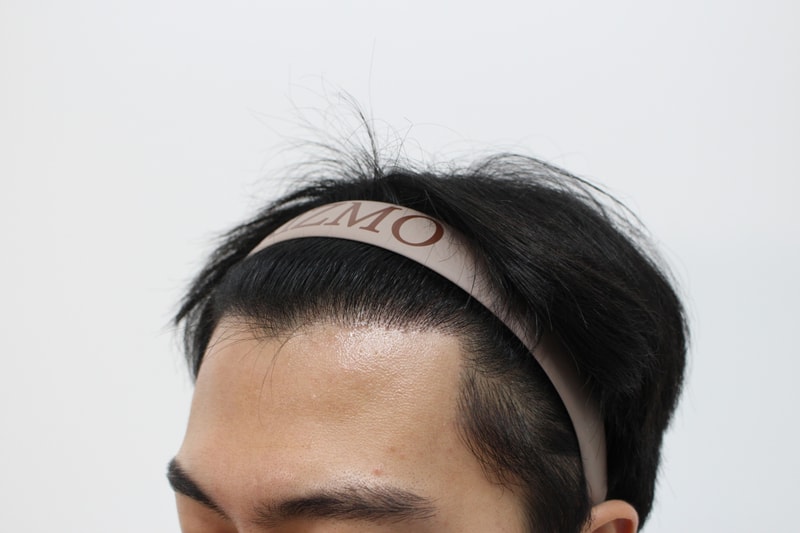 반대쪽 8개월차.jpg