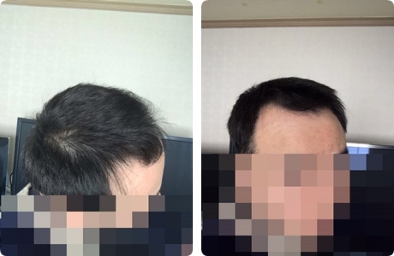 꾸미기_f7aUd0152mzcpasp6pg7_uq4sbl-horz.jpg