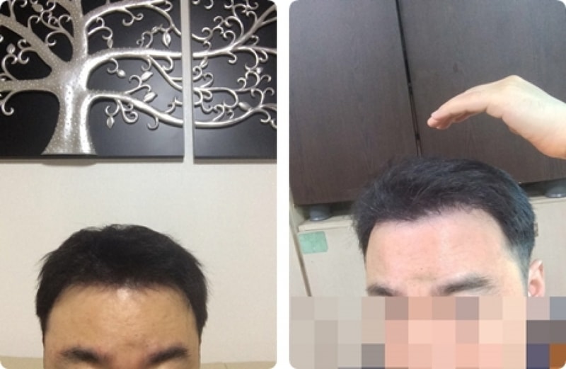 꾸미기_c9iUd015ye310xdzwqxk_lh1e5h-horz.jpg