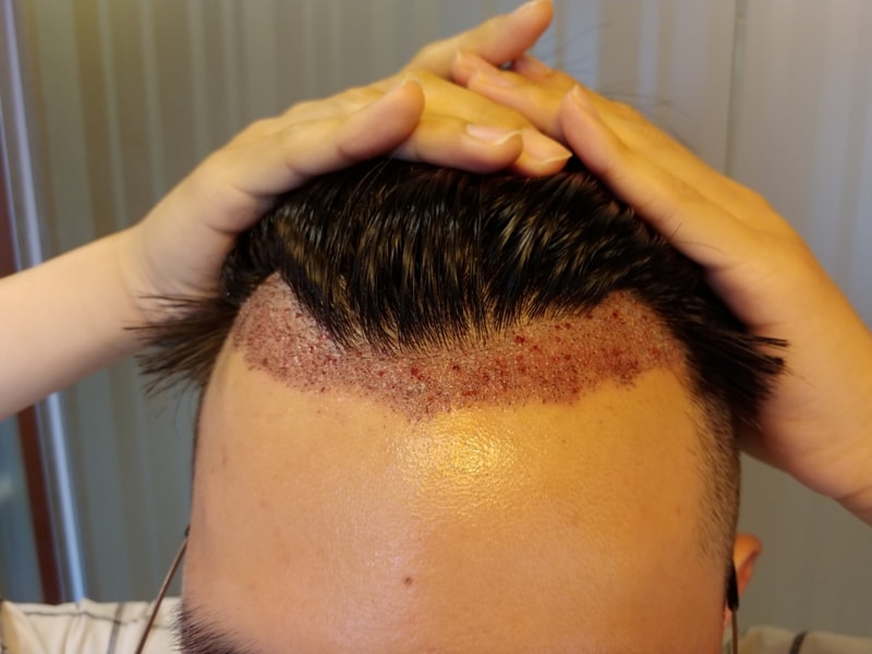KakaoTalk_20180726_225740029.jpg
