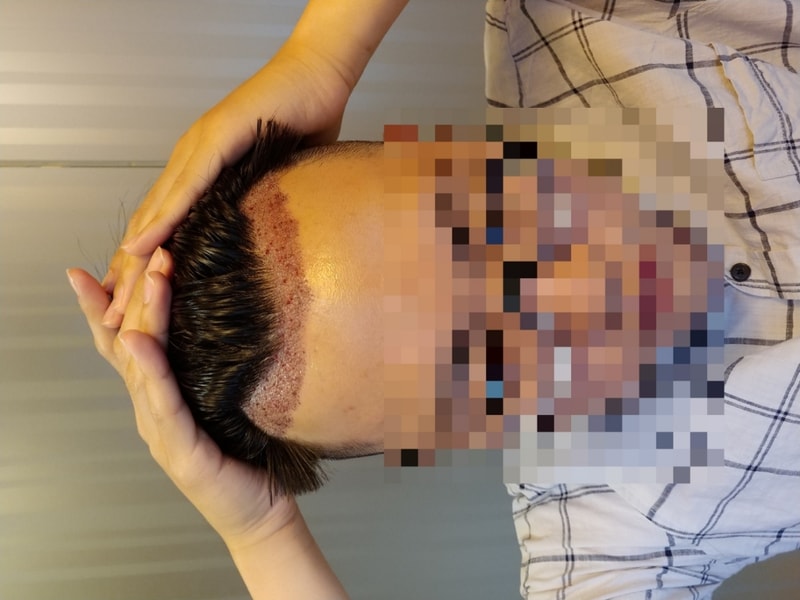 2700모 이식한지 2틀째입니다