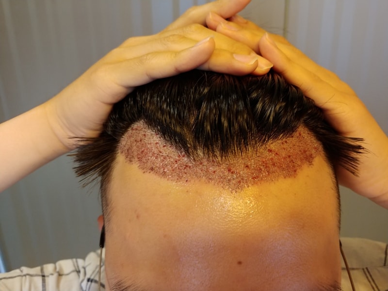KakaoTalk_20180726_225740784.jpg