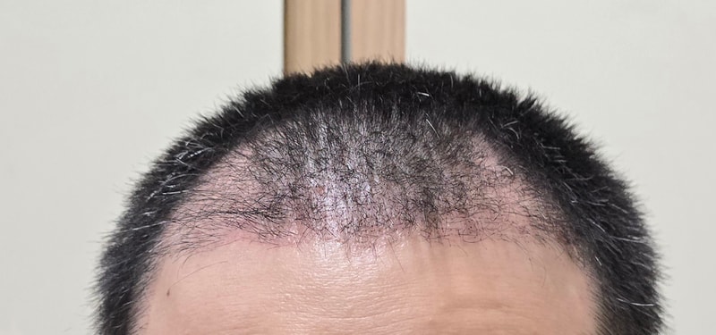 포토후기 이미지