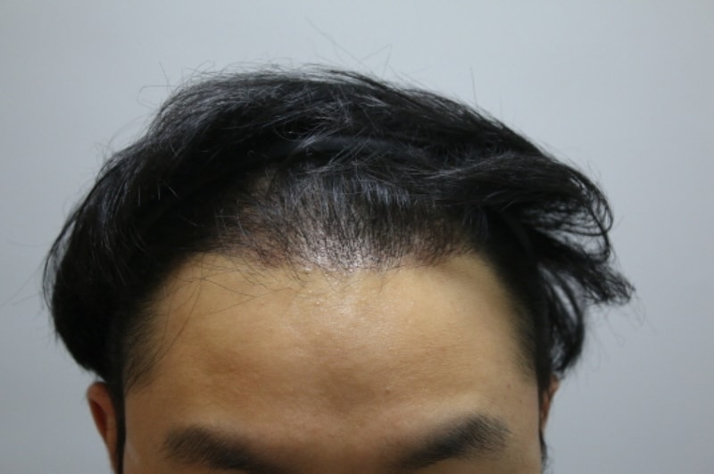 6주하고 약간 넘었습니다 상태좀 봐주세요