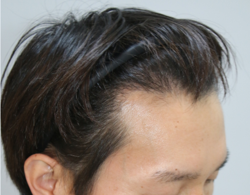 20150318_100006.png