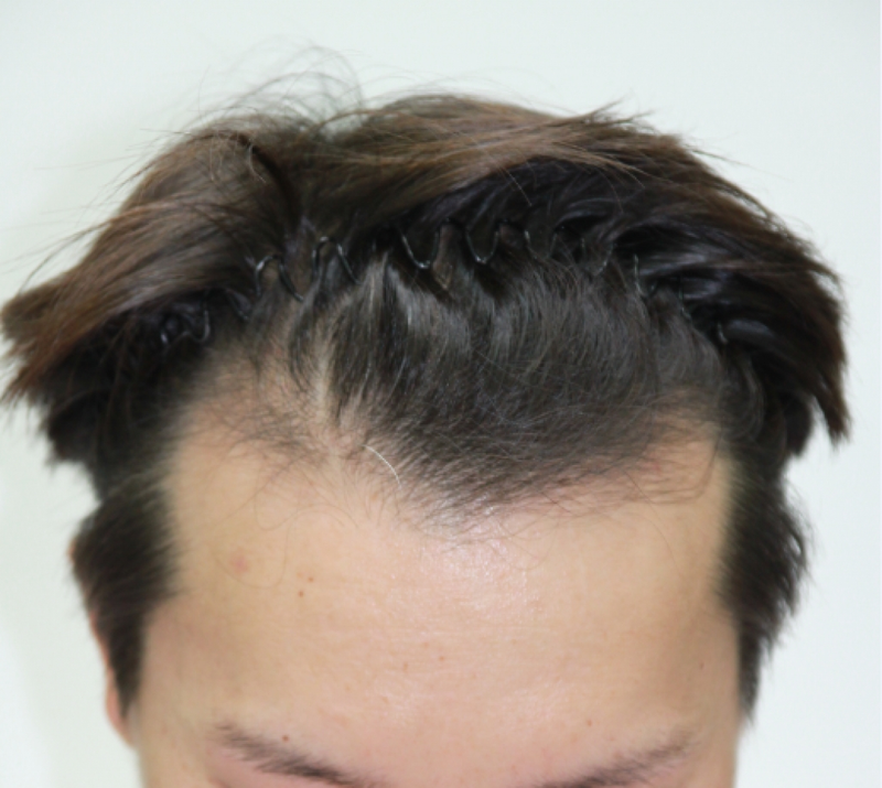 20150318_100327.png
