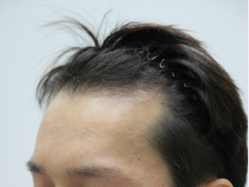 20150318_095903.png