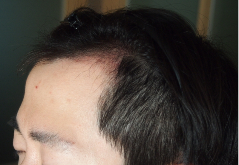 20150309_141620.png